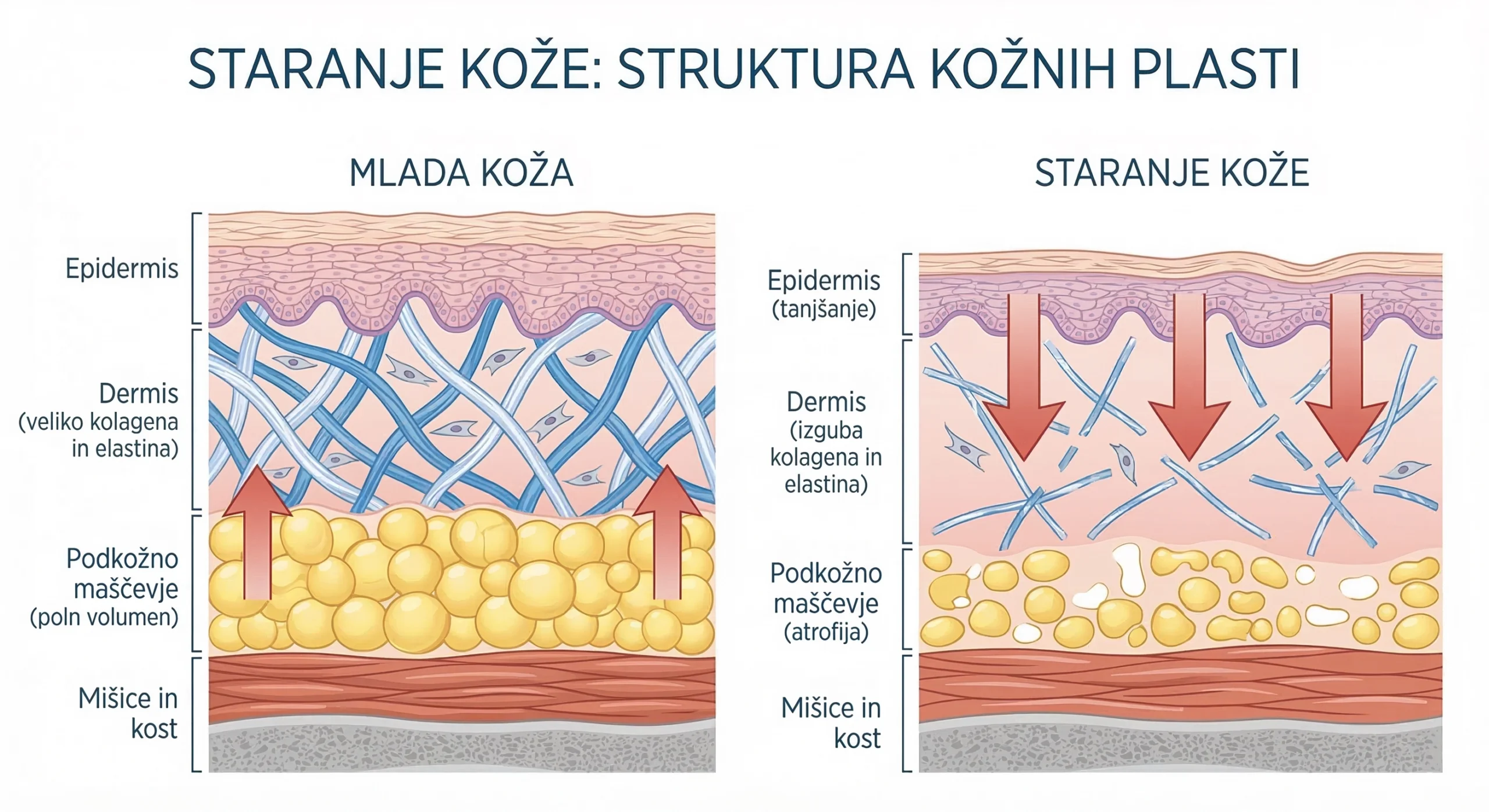 Prikaz razlike med mlado in starajočo se kožo obraza z izgubo kolagena, elastina in podkožnega maščevja.