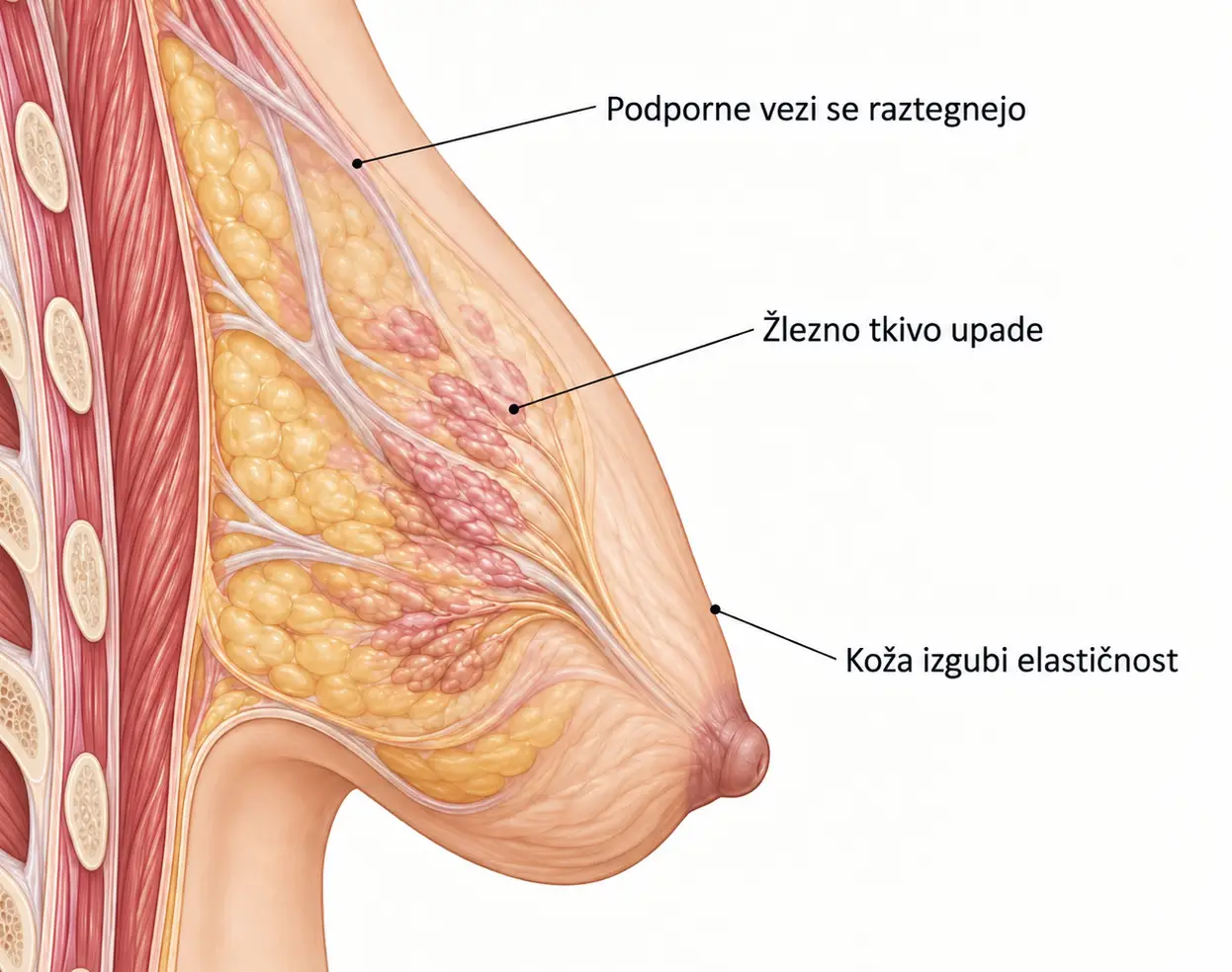 Anatomski prikaz sprememb tkiva pri povešenih dojkah